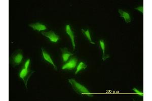 Immunofluorescence of monoclonal antibody to ZNF174 on HeLa cell.