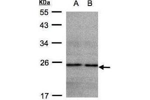 WB Image Sample(30 ug whole cell lysate) A: HeLa S3, B: Hep G2 , 12% SDS PAGE antibody diluted at 1:500