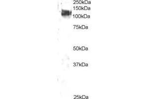 ABIN184673 staining (2µg/ml) of 3T3 lysate (RIPA buffer, 35µg total protein per lane). (CBL anticorps  (C-Term))