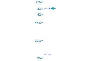 Image no. 1 for Fibroblast Growth Factor Receptor-Like 1 (FGFRL1) (AA 1-504) protein (GST tag) (ABIN1354049)