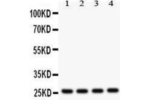 Western Blotting (WB) image for anti-Fms-Related tyrosine Kinase 3 Ligand (FLT3LG) (AA 79-110), (N-Term) antibody (ABIN3042394) (FLT3LG anticorps  (N-Term))