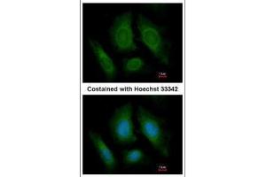 ICC/IF Image Immunofluorescence analysis of paraformaldehyde-fixed HeLa, using OSBPL6, antibody at 1:200 dilution.