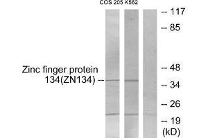 Western blot analysis of extracts from COS-7 cells and K562 cells, using ZNF134 antibody. (ZNF134 anticorps  (Internal Region))