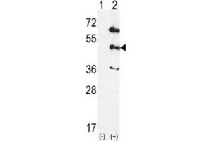 Western Blotting (WB) image for anti-Mitogen-Activated Protein Kinase 12 (MAPK12) antibody (ABIN3003059) (MAPK12 anticorps)