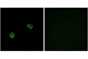 Immunofluorescence analysis of A549 cells, using GPR116 Antibody.