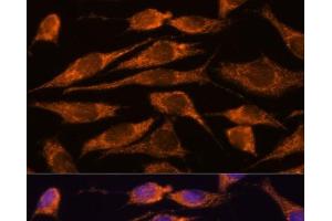 Immunofluorescence analysis of L929 cells using MTMR9 Polyclonal Antibody at dilution of 1:100.