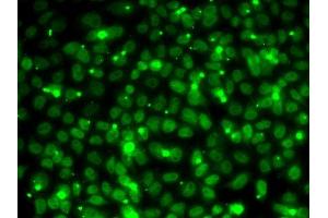 Immunofluorescence analysis of MCF7 cells using RP antibody (ABIN6128654, ABIN6147085, ABIN6147087 and ABIN6218282). (RPA3 anticorps  (AA 6-121))