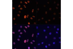 Immunofluorescence analysis of C6 cells using Acetyl-Histone H2B-K12 antibody (ABIN7267731) at dilution of 1:100.