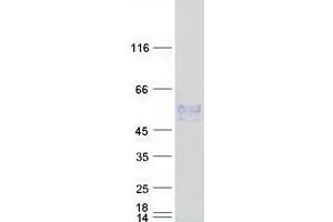 Validation with Western Blot