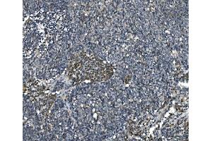 IHC analysis of eRF1/ETF1 using anti-eRF1/ETF1 antibody (ABIN7602626). (ETF1 anticorps  (AA 9-342))