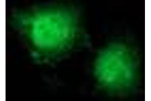 Image no. 9 for anti-Catenin (Cadherin-Associated Protein), beta 1, 88kDa (CTNNB1) antibody (ABIN1496890) (CTNNB1 anticorps)