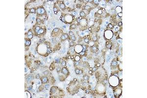 Immunohistochemistry of paraffin-embedded human liver using Perilipin-2 Rabbit pAb (ABIN6127414, ABIN6145773, ABIN6145774 and ABIN6221871) at dilution of 1:50 (40x lens).