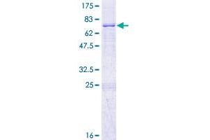Image no. 1 for Methylmalonic Aciduria (Cobalamin Deficiency) Type A (MMAA) (AA 1-418) protein (GST tag) (ABIN1311037)