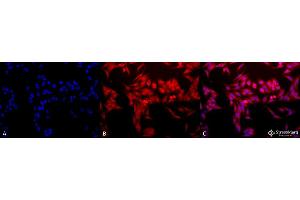 Immunocytochemistry/Immunofluorescence analysis using Rabbit Anti-HO-1 Polyclonal Antibody . (HMOX1 anticorps  (PE))