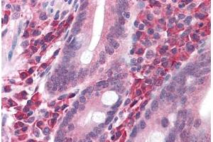 Human Small Intestine: Formalin-Fixed, Paraffin-Embedded (FFPE)