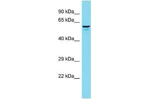 Host: Rabbit Target Name: FRMD1 Sample Type: 293T Whole Cell lysates Antibody Dilution: 1. (FRMD1 anticorps  (N-Term))