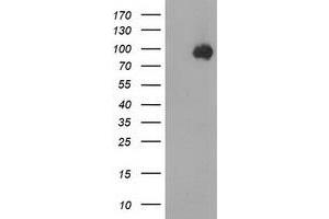 Western Blotting (WB) image for anti-Catenin (Cadherin-Associated Protein), beta 1, 88kDa (CTNNB1) antibody (ABIN1496894) (CTNNB1 anticorps)