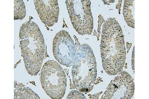 IHC analysis of PDCD6IP using anti-PDCD6IP antibody (ABIN7600490). (ALIX anticorps  (AA 2-330))