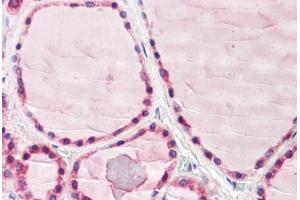 Image no. 2 for anti-Adenylate Cyclase 6 (ADCY6) (AA 794-843) antibody (ABIN1492309)