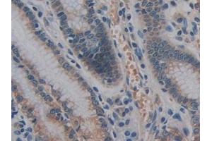 Detection of GPLD1 in Human Stomach Tissue using Polyclonal Antibody to Glycosylphosphatidylinositol Specific Phospholipase D1 (GPLD1) (GPLD1 anticorps  (AA 496-840))