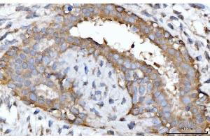 IHC analysis of GNB3 using anti-GNB3 antibody (ABIN7599726).
