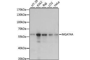 Western blot analysis of extracts of various cell lines, using MGA antibody (ABIN7268393) at 1:1000 dilution. (MGAT4A anticorps  (AA 28-100))