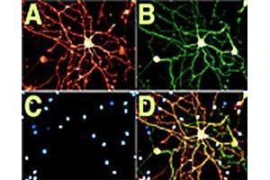 Immunofluorescent detection in cultured rat dorsal root ganglion (DRG). (NGFR anticorps)