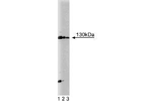 Western blot analysis of JAK1 on Jurkat cell lysate. (JAK1 anticorps  (AA 551-766))