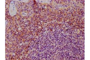 IHC image of ABIN7156884 diluted at 1:600 and staining in paraffin-embedded human tonsil tissue performed on a Leica BondTM system. (IL-3 anticorps  (AA 20-152))