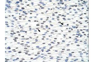 anti-Adenosine Deaminase, tRNA-Specific 1 (ADAT1) (AA 390-439) antibody