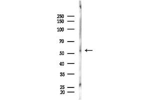 anti-Kruppel-Like Factor 11 (KLF11) (N-Term) antibody