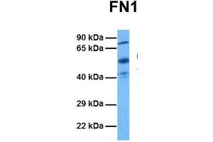 Host:  Rabbit  Target Name:  FN1  Sample Tissue:  Human Ovary Tumor  Antibody Dilution:  1. (Fibronectin 1 anticorps  (C-Term))