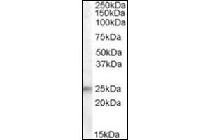Western Blot: Antibody (0. (IGFBP6 anticorps  (Internal Region))