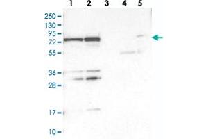 Western blot analysis of Lane 1: RT-4, Lane 2: U-251 MG, Lane 3: Human Plasma, Lane 4: Liver, Lane 5: Tonsil with PTCD1 polyclonal antibody . (PTCD1 anticorps)