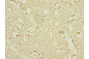 Immunohistochemistry of paraffin-embedded human brain tissue using ABIN7164317 at dilution of 1:100