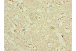 Immunohistochemistry of paraffin-embedded human brain tissue using ABIN7164317 at dilution of 1:100 (DHTKD1 anticorps  (AA 1-280))