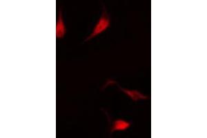 ABIN6267578 staining HuvEc by IF/ICC.