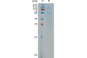 Human (54-617) Protein, His Tag on SDS-PAGE under reducing condition.