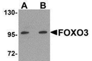 Western Blotting (WB) image for anti-Forkhead Box O3 (FOXO3) (N-Term) antibody (ABIN2473691) (FOXO3 anticorps  (N-Term))