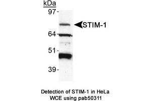 Image no. 1 for anti-Stromal Interaction Molecule 1 (STIM1) (AA 600-685), (C-Term) antibody (ABIN363620) (STIM1 anticorps  (C-Term))
