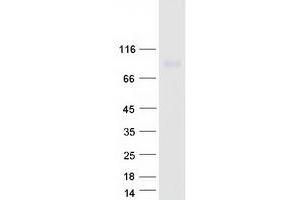 Validation with Western Blot