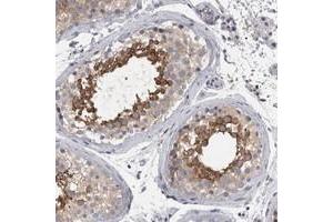 Immunohistochemical staining of human testis with LYZL6 polyclonal antibody  shows strong cytoplasmic positivity in subsets of seminiferus duct cells. (LYZL6 anticorps)