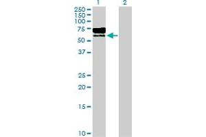 Western Blot analysis of TPP1 expression in transfected 293T cell line by TPP1 MaxPab polyclonal antibody. (TPP1 anticorps  (AA 1-563))