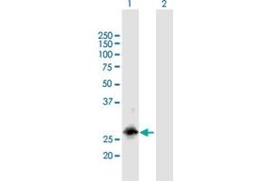 Western Blot analysis of RBM38 expression in transfected 293T cell line by RBM38 MaxPab polyclonal antibody. (RBM38 anticorps  (AA 1-239))