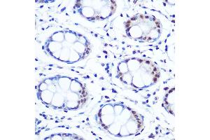 Immunohistochemistry of paraffin-embedded human colon using // Rabbit mAb (ABIN7265650) at dilution of 1:100 (40x lens).