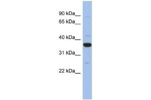 MYD88 antibody used at 1 ug/ml to detect target protein. (MYD88 anticorps)