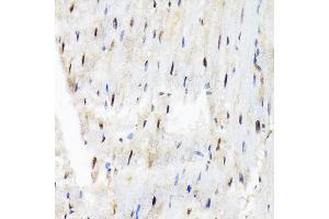 Immunohistochemistry of paraffin-embedded rat heart using SF3B3/S Rabbit mAb (ABIN7270544) at dilution of 1:100 (40x lens). (SF3B3 anticorps)