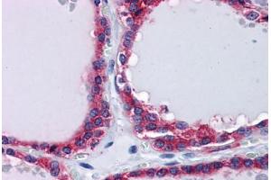 Human Thyroid: Formalin-Fixed, Paraffin-Embedded (FFPE) (PLIN3 anticorps  (AA 1-435))