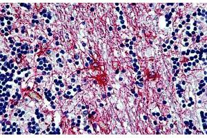 Human Cerebellum: Formalin-Fixed, Paraffin-Embedded (FFPE)