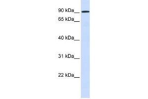 WB Suggested Anti-HKR1 Antibody Titration:  0. (HKR1 anticorps  (N-Term))